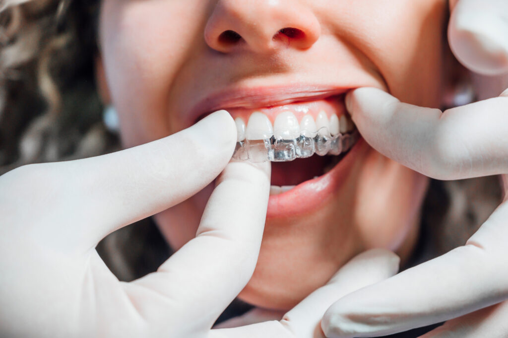 seattle orthodontics